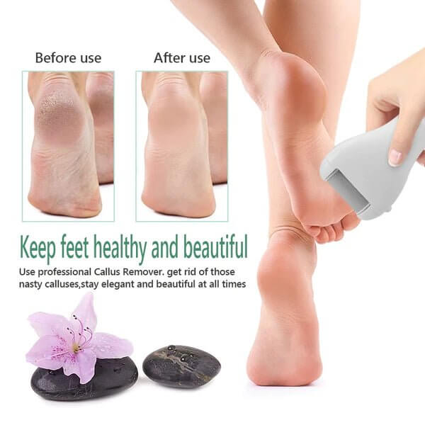 Selection Guide for Electric Foot File Pedicure Tools